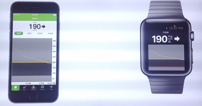 01-2-DexCom-apple-watch