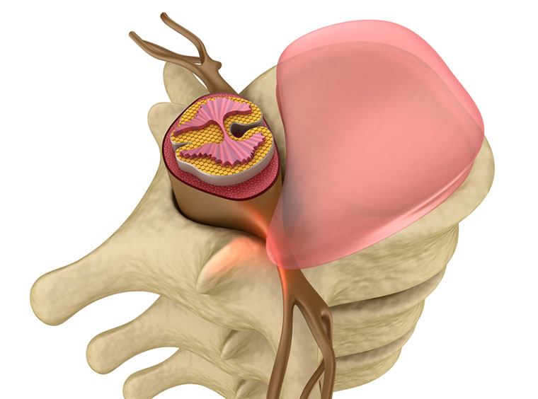02-No-Back-Problems-Sport