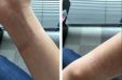 Купил в МТС ремешок для Apple Watch, теперь чешется рука