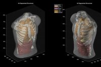 ultrasound_phantom_segmentation-b254a71d083eb5c9 Безопаснее, чем МРТ. Создатели Midjourney представили ИИ-сканер, которым можно проверять органы тела хоть каждый день